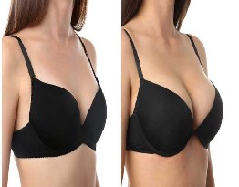 Breast Augmentation